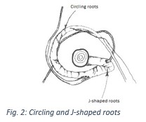 Circling and J-shaped roots